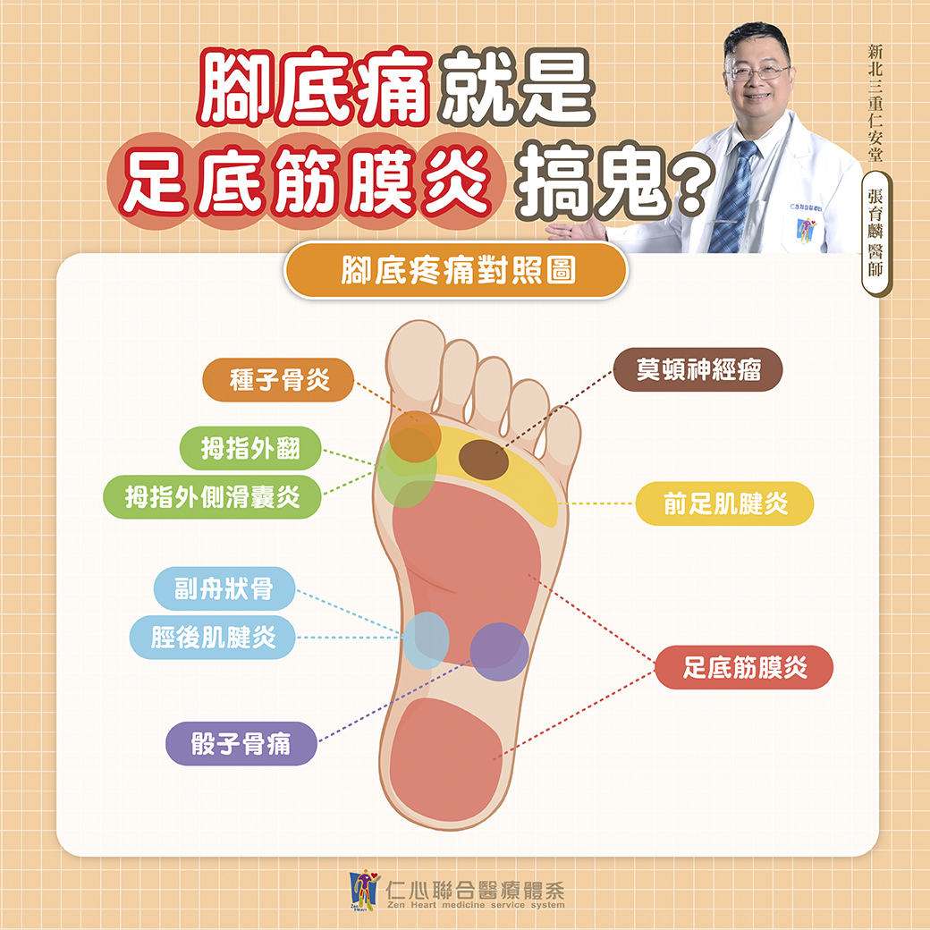 腳底痛是不是足底筋膜炎的徵兆?這張圖帶您了解不同腳底痛的成因,讓您快速辨識並及早治療。從種子骨炎、腳指外翻、到副舟骨和腓骨痛,每一個疼痛點都有可能是不同問題的徵兆。特別是當出現足底筋膜炎時,常會讓您感到腳底與腳跟的劇烈不適。如果您有類似症狀,請別忽視,及時就醫診斷是關鍵!快來了解更多腳底疼痛的解決方法,讓您告別不適,重拾輕鬆行走的日常!